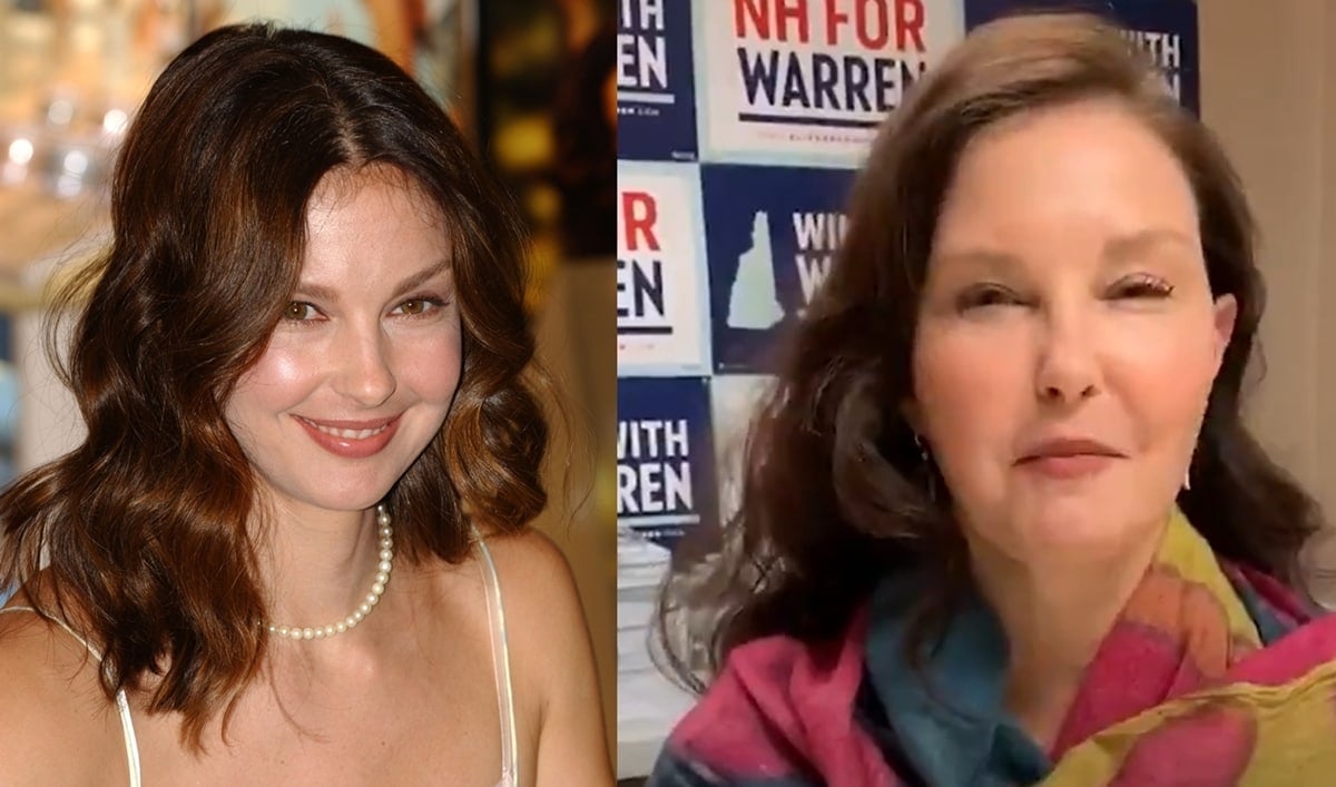 Ashley Judd face accident